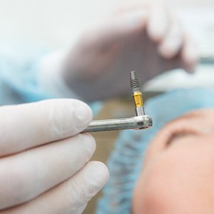 Closeup of implant about to be placed