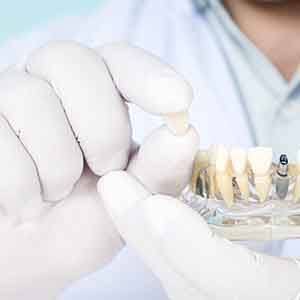 diagram of dental implant, abutment, and crown