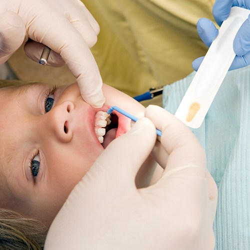 Child receiving fluoride treatment