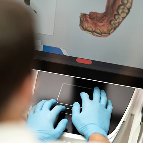 Dentist looking at digital impressions
